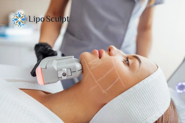 HIFU vs Botulinum Toxin: Understanding the Differences 1 HIFU vs Botox Stroud What is the best option for you?