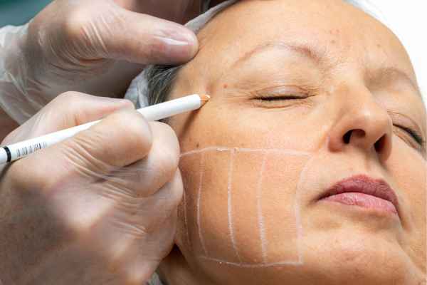 CryoPen: 5 Skin Concerns It May Be Used to Treat 4 What should you ask before having CryoPen treatment Stroud?