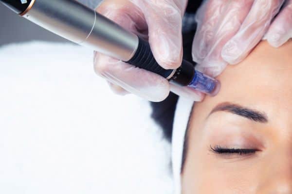 Explaining Total Skin Tightening Treatment and What to Expect 2 What Skin Concerns Can Total Skin Tightening Treatment Help With Stroud?